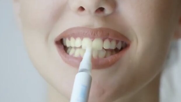 Зуби. Фото: скріншот YouTube-відео