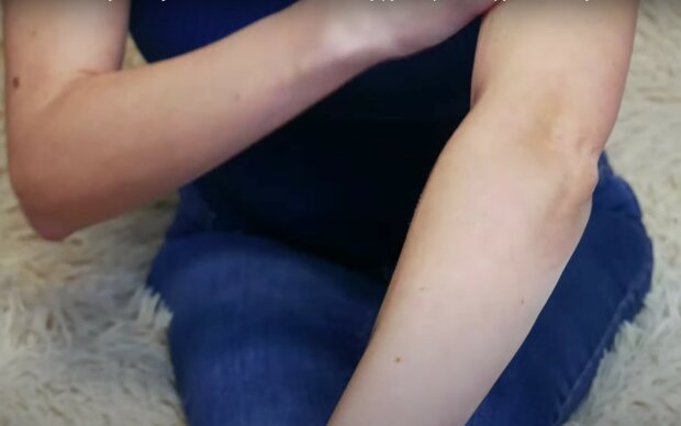 Шкіра на ліктях. Фото: скріншот YouTube-відео