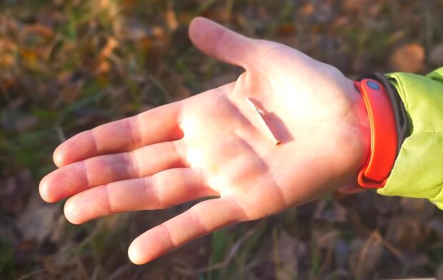 Следите за детьми: во Львовской области мальчику оторвало пальцы из-за петарды