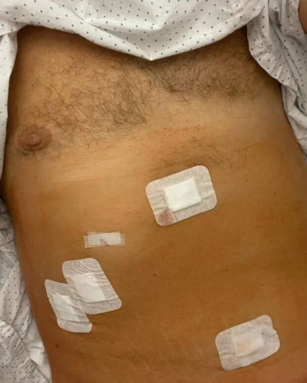 Сториз Потапа