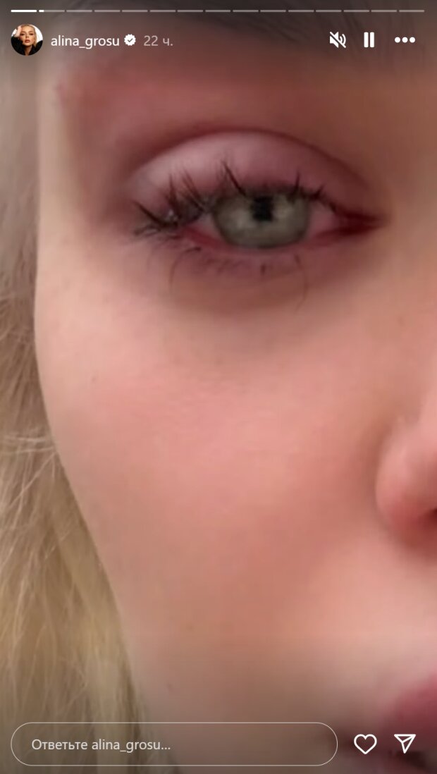 Сториз Аліни Гросу