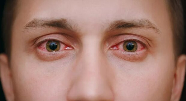 Червоні очі