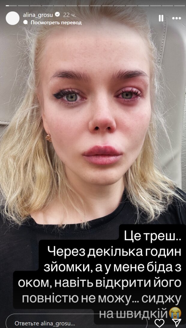 Сториз Аліни Гросу