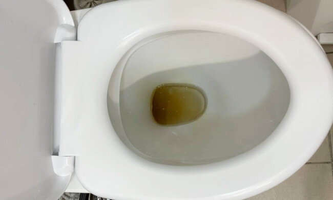 Допоможе стара наволочка: азіатська хитрість, завдяки якій унітаз виблискуватиме як новий