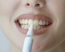 Зубы. Фото: скриншот YouTube-видео