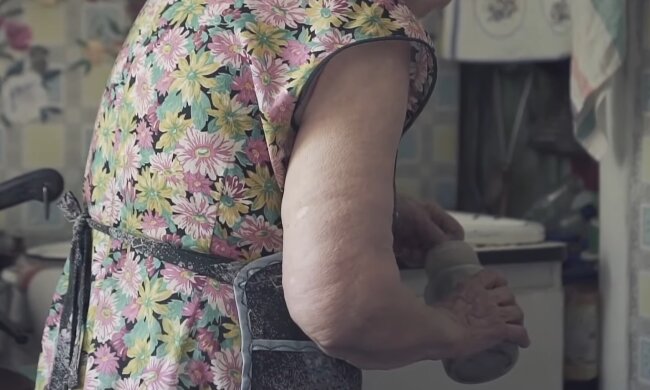 «Славная» российская медицина. В РФ пенсионерка прооперировала себя, не дождавшись «скорой»