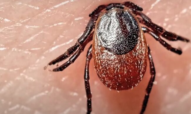 Бережіть своїх дітей. В Одесі хлопчика паралізувало через укус кліща