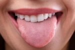 Пора готовиться к неприятностям: о каких проблемах со здоровьем можно узнать по внешнему виду языка